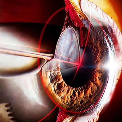 eye2